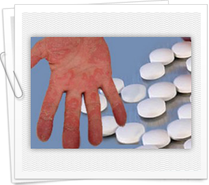 Where to get info about new psoriasis medications