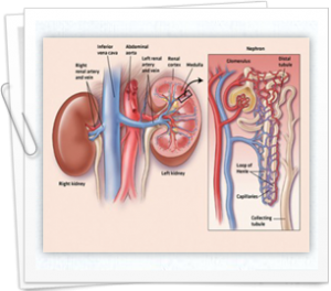 The long term solution to chronic kidney diseases