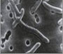 microscopic view of bloodborne pathogens