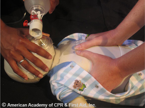 Two rescuers compression around the chest on infant